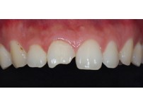 치료전후이미지