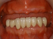 치료전후이미지