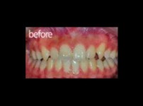 치료전후이미지