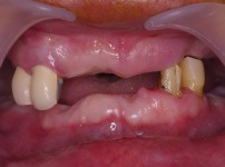 치료전후이미지