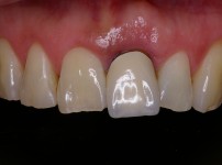 치료전후이미지