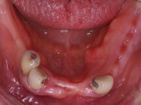 치료전후이미지