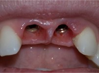 치료전후이미지