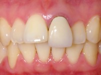 치료전후이미지