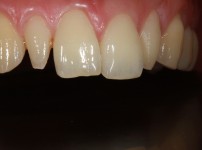 치료전후이미지