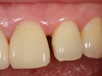 치료전후이미지