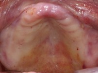 치료전후이미지