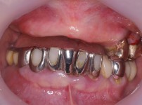 치료전후이미지