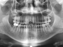 치료전후이미지