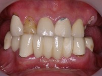 치료전후이미지