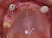 치료전후이미지