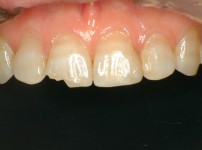 치료전후이미지