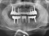 치료전후이미지