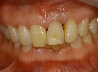 치료전후이미지