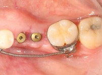 치료전후이미지