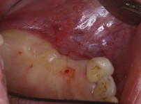 치료전후이미지