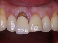 치료전후이미지