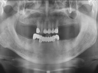 치료전후이미지