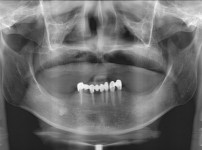 치료전후이미지