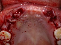 치료전후이미지