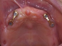 치료전후이미지