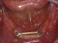 치료전후이미지