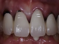 치료전후이미지