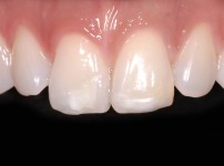 치료전후이미지