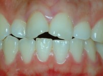 치료전후이미지