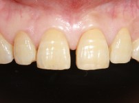 치료전후이미지