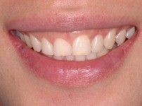 치료전후이미지