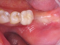 치료전후이미지