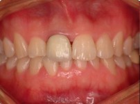 치료전후이미지