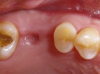 치료전후이미지