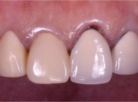 치료전후이미지