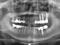 치료전후이미지