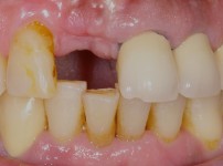 치료전후이미지