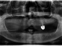 치료전후이미지