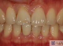 치료전후이미지