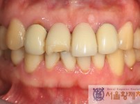 치료전후이미지