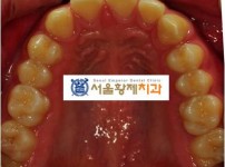 치료전후이미지