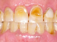 치료전후이미지