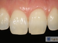 치료전후이미지