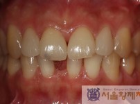 치료전후이미지