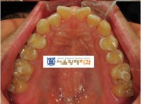 치료전후이미지