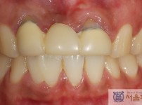 치료전후이미지