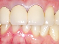 치료전후이미지