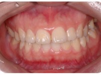 치료전후이미지