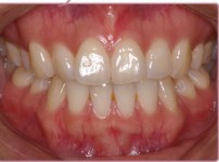 치료전후이미지