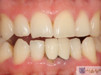 치료전후이미지